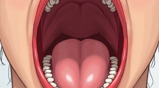 blood-blister-in-the-throat-causes