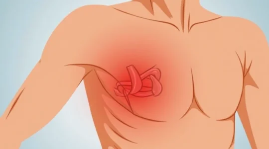 pain-in-the-left-armpit-common-causes